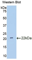 IL18BP Antibody - Western Blot; Sample: Recombinant protein.