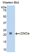 IL18BP Antibody - Western Blot; Sample: Recombinant protein.