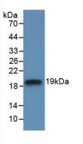 IL18BP Antibody - Western Blot; Sample: Recombinant IL18BP, Human.