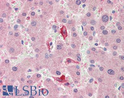 IL18BP Antibody - Human Liver: Formalin-Fixed, Paraffin-Embedded (FFPE)