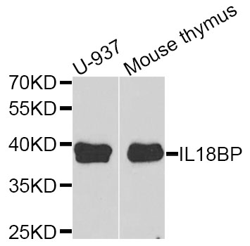 IL18BP Antibody - Western blot analysis of extracts of various cell lines.