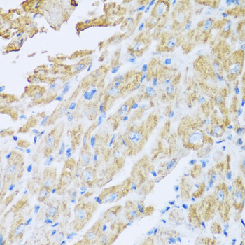 IL18BP Antibody - Immunohistochemistry of paraffin-embedded mouse heart.