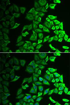 IL18BP Antibody - Immunofluorescence analysis of A549 cells.