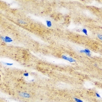 IL18BP Antibody - Immunohistochemical analysis of IL-18BP staining in mouse heart formalin fixed paraffin embedded tissue section. The section was pre-treated using heat mediated antigen retrieval with sodium citrate buffer (pH 6.0). The section was then incubated with the antibody at room temperature and detected using an HRP conjugated compact polymer system. DAB was used as the chromogen. The section was then counterstained with hematoxylin and mounted with DPX.