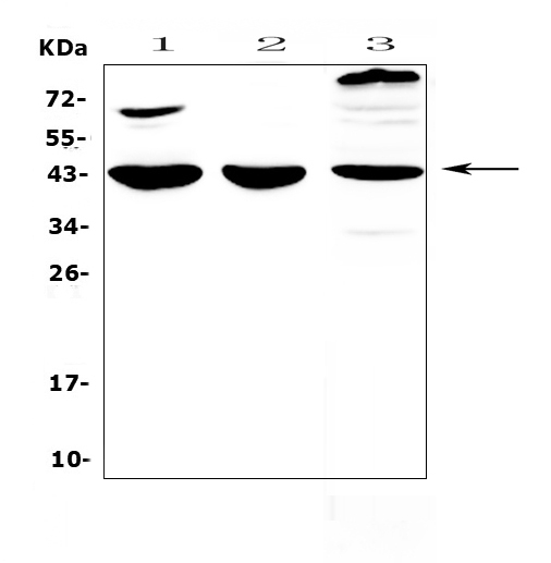 IL18BP Antibody - Western blot analysis of IL18 binding protein using anti-IL18 binding protein antibody. Electrophoresis was performed on a 5-20% SDS-PAGE gel at 70V (Stacking gel) / 90V (Resolving gel) for 2-3 hours. The sample well of each lane was loaded with 50ug of sample under reducing conditions. Lane 1: mouse heart tissue lysate,Lane 2: mouse brain tissue lysate,Lane 3: rat heart tissue lysate. After Electrophoresis, proteins were transferred to a Nitrocellulose membrane at 150mA for 50-90 minutes. Blocked the membrane with 5% Non-fat Milk/ TBS for 1.5 hour at RT. The membrane was incubated with rabbit anti-IL18 binding protein antigen affinity purified polyclonal antibody at 0.5 µg/mL overnight at 4°C, then washed with TBS-0.1% Tween 3 times with 5 minutes each and probed with a goat anti-rabbit IgG-HRP secondary antibody at a dilution of 1:10000 for 1.5 hour at RT. The signal is developed using an Enhanced Chemiluminescent detection (ECL) kit with Tanon 5200 system. A specific band was detected for IL18 binding protein at approximately 43KD. The expected band size for IL18 binding protein is at 21KD.