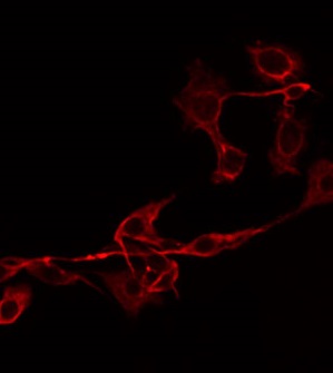 IL18BP Antibody - Staining HepG2 cells by IF/ICC. The samples were fixed with PFA and permeabilized in 0.1% Triton X-100, then blocked in 10% serum for 45 min at 25°C. The primary antibody was diluted at 1:200 and incubated with the sample for 1 hour at 37°C. An Alexa Fluor 594 conjugated goat anti-rabbit IgG (H+L) Ab, diluted at 1/600, was used as the secondary antibody.