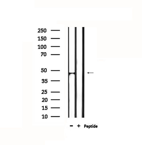 IL18BP Antibody - Western blot analysis of extracts of rat spleen using IL18BP antibody.