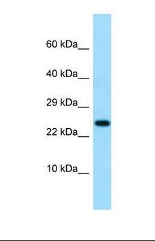 IL19 Antibody - Western blot of Human Jurkat. IL19 antibody dilution 1.0 ug/ml.  This image was taken for the unconjugated form of this product. Other forms have not been tested.