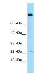 IL19 Antibody - IL19 / IL-19 antibody Western Blot of Placenta.  This image was taken for the unconjugated form of this product. Other forms have not been tested.