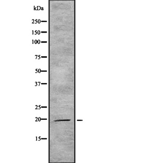IL19 Antibody - Western blot analysis IL19 using HeLa whole cells lysates