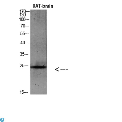 IL19 Antibody - Western blot analysis of rat brain lysate, antibody was diluted at 500. Secondary antibody was diluted at 1:20000.