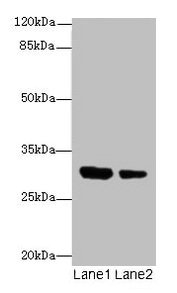 IL1A / IL-1 Alpha Antibody - Western blot All lanes: IL1A antibody at 6µg/ml Lane 1: Jurkat whole cell lysate Lane 2: Human placenta tissue Secondary Goat polyclonal to rabbit IgG at 1/10000 dilution Predicted band size: 31 kDa Observed band size: 31 kDa