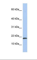IL1A / IL-1 Alpha Antibody - Fetal liver lysate. Antibody concentration: 1.0 ug/ml. Gel concentration: 10-20%.  This image was taken for the unconjugated form of this product. Other forms have not been tested.