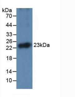 IL1A / IL-1 Alpha Antibody