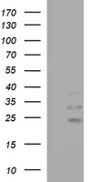 IL1A / IL-1 Alpha Antibody - HEK293T cells lysate (5 ug, left lane) and full length human recombinant protein of human IL1A(NP_000566) produced in HEK293T cell (5 ug, right lane)were separated by SDS-PAGE and immunoblotted with anti-IL1A.