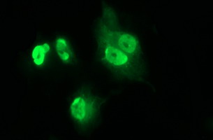 IL1A / IL-1 Alpha Antibody - Anti-IL1A mouse monoclonal antibody immunofluorescent staining of COS7 cells transiently transfected by pCMV6-ENTRY IL1A.