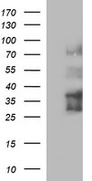 IL1A / IL-1 Alpha Antibody - HEK293T cells lysate (5ug, left lane) and full length human recombinant protein of human IL1A(NP_000566) produced in HEK293T cell (5ug, right lane)were separated by SDS-PAGE and immunoblotted with anti-IL1A.