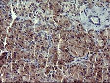 IL1A / IL-1 Alpha Antibody - IHC of paraffin-embedded Human pancreas tissue using anti-IL1A mouse monoclonal antibody. (Heat-induced epitope retrieval by 10mM citric buffer, pH6.0, 120°C for 3min).