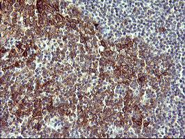 IL1A / IL-1 Alpha Antibody - IHC of paraffin-embedded Human lymph node tissue using anti-IL1A mouse monoclonal antibody. (Heat-induced epitope retrieval by 10mM citric buffer, pH6.0, 120°C for 3min).