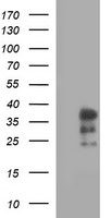 IL1A / IL-1 Alpha Antibody - HEK293T cells lysate (5 ug, left lane) and full length human recombinant protein of human IL1A(NP_000566) produced in HEK293T cell (5 ug, right lane)were separated by SDS-PAGE and immunoblotted with anti- IL1A.