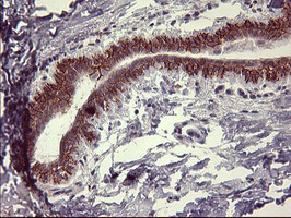 IL1A / IL-1 Alpha Antibody - IHC of paraffin-embedded Human breast tissue using anti-IL1A mouse monoclonal antibody. (Heat-induced epitope retrieval by 10mM citric buffer, pH6.0, 120°C for 3min).