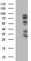 IL1A / IL-1 Alpha Antibody - HEK293T cells lysate (5 ug, left lane) and full length human recombinant protein of human IL1A(NP_000566) produced in HEK293T cell (5 ug, right lane)were separated by SDS-PAGE and immunoblotted with anti-IL1A.