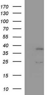 IL1A / IL-1 Alpha Antibody - Negative control HEK293T lysate (Left lane) or full length human recombinant protein of human IL1A(NP_000566) produced in HEK293T cell(Right lane). Equivalent amounts (5 ug per lane) were separated by SDS-PAGE and then immunoblotted with anti-IL1A. .