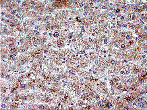 IL1A / IL-1 Alpha Antibody - IHC of paraffin-embedded Human liver tissue using anti-IL1A mouse monoclonal antibody. (Heat-induced epitope retrieval by 10mM citric buffer, pH6.0, 120°C for 3min).