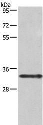 IL1A / IL-1 Alpha Antibody - Western blot analysis of Jurkat cell, using IL1A Polyclonal Antibody at dilution of 1:666.