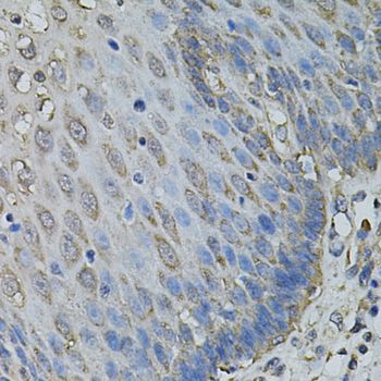 IL1A / IL-1 Alpha Antibody - Immunohistochemistry of paraffin-embedded human esophagus using IL1A antibody at dilution of 1:100 (40x lens).