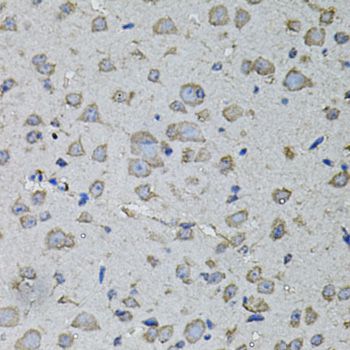 IL1A / IL-1 Alpha Antibody - Immunohistochemistry of paraffin-embedded mouse brain using IL1A antibody at dilution of 1:100 (40x lens).
