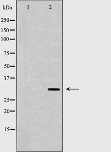 IL1A / IL-1 Alpha Antibody - Western blot analysis of extracts of skin using IL1A antibody. The lane on the left is treated with the antigen-specific peptide.
