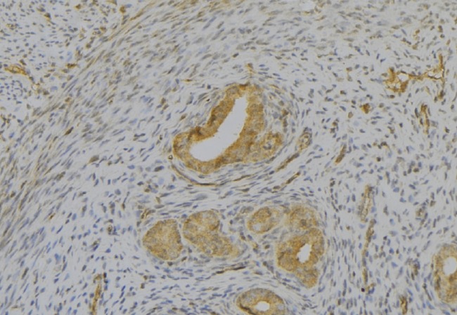 IL1A / IL-1 Alpha Antibody - 1:100 staining human uterus tissue by IHC-P. The sample was formaldehyde fixed and a heat mediated antigen retrieval step in citrate buffer was performed. The sample was then blocked and incubated with the antibody for 1.5 hours at 22°C. An HRP conjugated goat anti-rabbit antibody was used as the secondary.