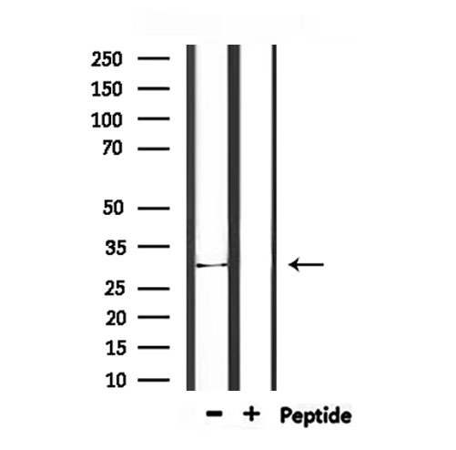 IL1A / IL-1 Alpha Antibody - Western blot analysis of extracts of mouse brain tissue using IL1A antibody.