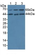IL1A / IL-1 Alpha Antibody - Western Blot; Sample: Lane1: Human Lung Tissue; Lane2: Human Jurkat Cells; Lane3: Rat Placenta Tissue.