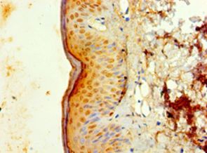 IL1F10 Antibody - Immunohistochemistry of paraffin-embedded human skin tissue using antibody at 1:100 dilution.  This image was taken for the unconjugated form of this product. Other forms have not been tested.