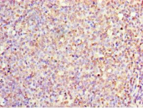 IL1F10 Antibody - Immunohistochemistry of paraffin-embedded human tonsil tissue using antibody at 1:100 dilution.  This image was taken for the unconjugated form of this product. Other forms have not been tested.