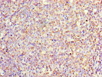 IL1F10 Antibody - Immunohistochemistry of paraffin-embedded human tonsil tissue using IL1F10 Antibody at dilution of 1:100