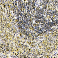 IL1F10 Antibody - Immunohistochemical analysis of IL-1F10 staining in human spleen formalin fixed paraffin embedded tissue section. The section was pre-treated using heat mediated antigen retrieval with sodium citrate buffer (pH 6.0). The section was then incubated with the antibody at room temperature and detected using an HRP polymer system. DAB was used as the chromogen. The section was then counterstained with hematoxylin and mounted with DPX.