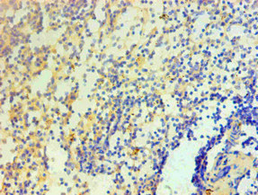 IL1F10 Antibody - Immunohistochemical of paraffin-embedded Human spleen tissue using IL1F10 Monoclonal Antibody at dilution of 1:200.
