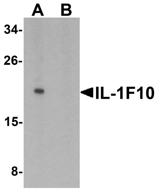 IL1F10 Antibody - Western blot analysis of IL-1F10 in human liver tissue lysate with IL-1F10 antibody at 1 ug/ml in (A) the absence and (B) the presence of blocking peptide.