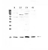 IL1F10 Antibody - Western blot - Anti-IL1F10/Il 38 Picoband antibody