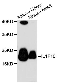 IL1F10 Antibody - Western blot analysis of extracts of various cell lines, using IL1F10 antibody at 1:3000 dilution. The secondary antibody used was an HRP Goat Anti-Rabbit IgG (H+L) at 1:10000 dilution. Lysates were loaded 25ug per lane and 3% nonfat dry milk in TBST was used for blocking. An ECL Kit was used for detection and the exposure time was 90s.