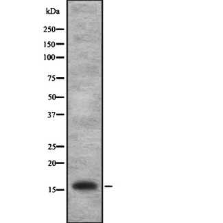 IL1F10 Antibody - Western blot analysis of IL1FA expression in HEK293 cells. The lane on the left is treated with the antigen-specific peptide.