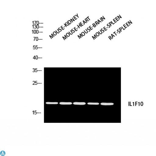 IL1F10 Antibody - Western Blot (WB) analysis of Mouse Kidney Mouse Heart Mouse Brain Mouse Spleen Rat SPLEEN using IL1F10 antibody.