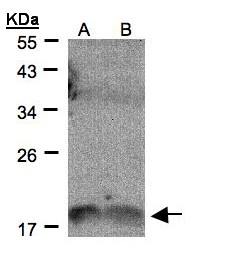 IL1F9 Antibody - Sample (30 ug of whole cell lysate). A: H1299, B: HeLa S3. 12% SDS PAGE. IL1F9 antibody diluted at 1:500