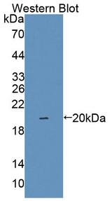 IL1F9 Antibody - Western blot of IL1F9 antibody.