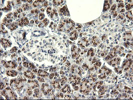 IL1F9 Antibody - IHC of paraffin-embedded Human pancreas tissue using anti-IL1F9 mouse monoclonal antibody. (Heat-induced epitope retrieval by 10mM citric buffer, pH6.0, 120°C for 3min).