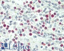 IL1F9 Antibody - Human Spleen, Neutrophils: Formalin-Fixed, Paraffin-Embedded (FFPE)
