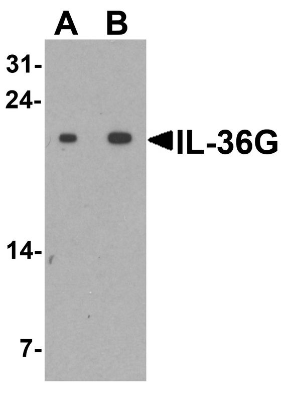 IL1F9 Antibody - Western blot analysis of IL-36G in human spleen tissue lysate with IL-36G antibody at (A) 1 and (B) 2 ug/ml.